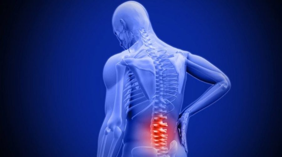 backpain.jpg